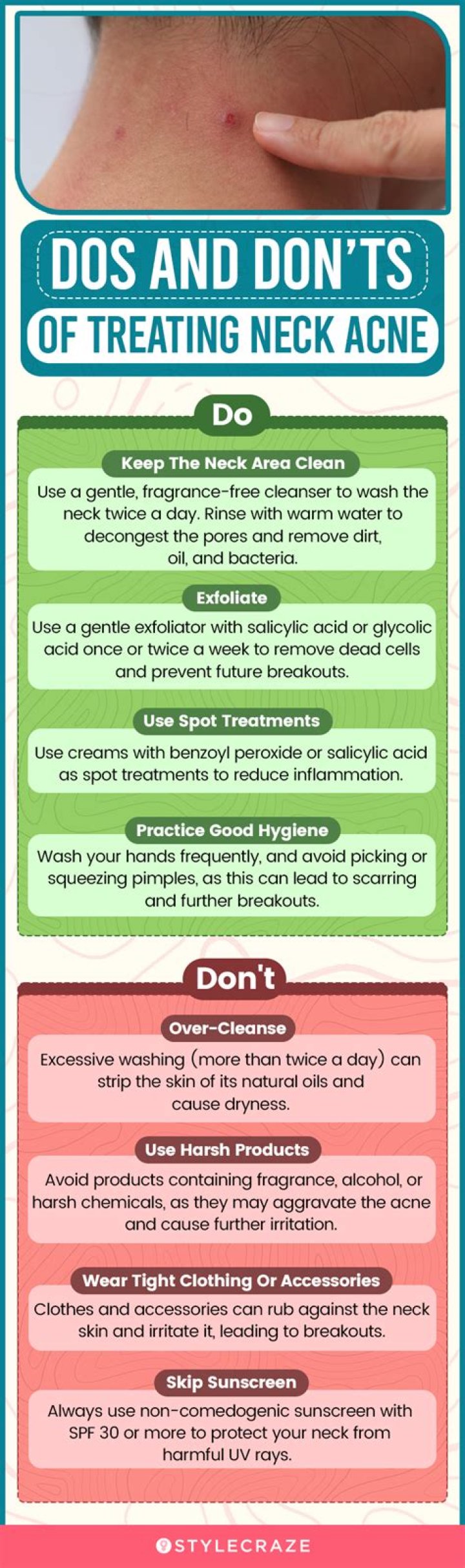 Acne on neck meaning - How To Discuss