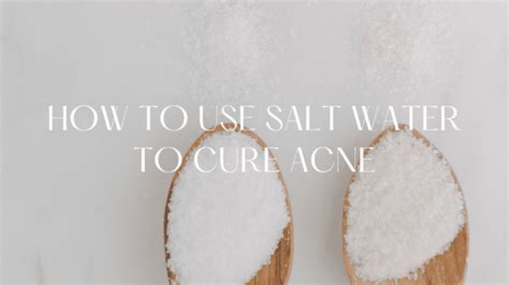 Does salt water help acne