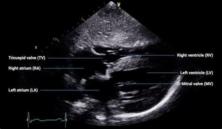 Echo sub - How To Discuss