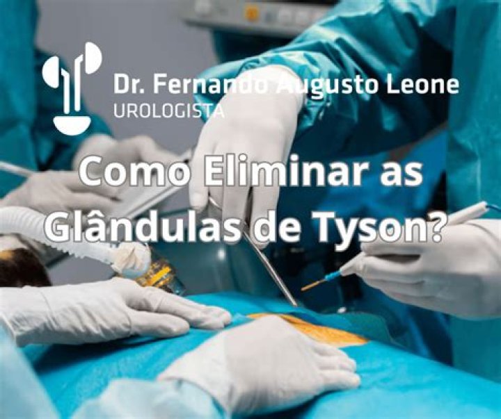Glandulas De Tyson Tratamento - How To Discuss