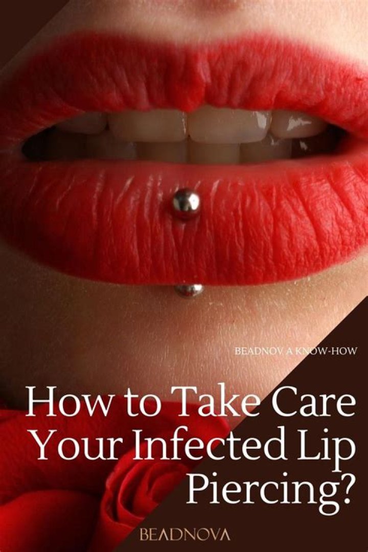 Infected Lip Piercing - How To Discuss