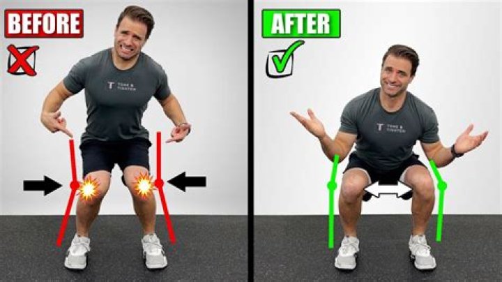 Quick Answer: How To Fix Knees Pointing Outward