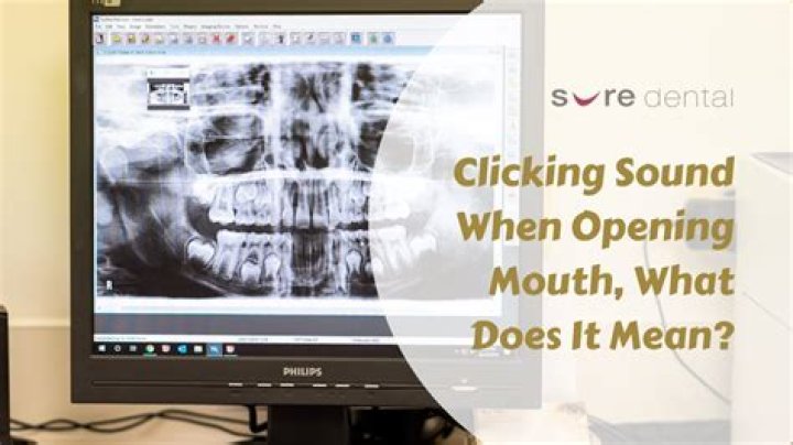 Teeth Making Clicking Sound When Pushed